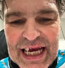 52-year-old 🇨🇿Jaromír Jágr sacrificed some teeth in today's Czech  Extraliga match 🦷😬 Jágr had an assist and 14:54 ice-time in a 4-2  comeback win for Rytíři Kladno against fourth-place Mountfield HK! 🇨🇿 #