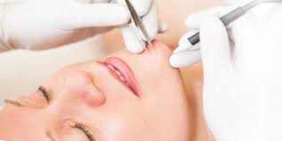 Why you should buy the best the pinchless electrolysis hair removal from amazon. 5 Situations Where Electrolysis Is The Best Hair Removal Option Coco Creme