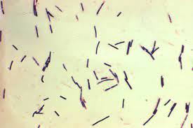 Under certain conditions, these organisms may grow in foods. Clostridium Perfringens Wikipedia