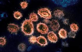 In humans, smallpox, the common cold, chickenpox, influenza, shingles, herpes, polio, rabies, ebola , hanta fever, and aids are examples of viral diseases. I Team New Lambda Coronavirus Variant Detected In Las Vegas Valley Klas