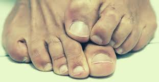 How to prepare your nails. Essential Oils For Toenail Fungus Top 8 3 Poweful Recipes To Try