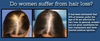 Fortunately, early treatment can stop and even. Hair Restoration Hair Regrowth New York