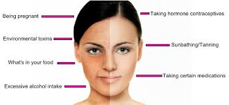 Fruits and vegetables with carotenes, for instance carrots, mangos, musk melon are rich sources of vitamin a should be included in the diet as far as. 7 Secret Reasons Your Skin Pigment Changes Colour Healthista