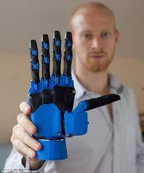 Could This 600 3d Printed Hand Help Thousands Of Amputees Prosthetics Robotic Prosthetics Prints