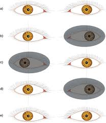 Pin On Diagnositic Tests