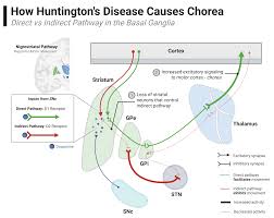 Image result for Chorea