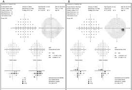 Can You Differentiate These Tough Glaucoma Cases