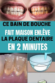 Une Mauvaise Hygiene Bucco Dentaire Peut Avoir Plusieurs Repercussions Sur La Sante Des Dents Et Des Genc In 2020 Natural Oral Care Oral Health Care Homemade Mouthwash