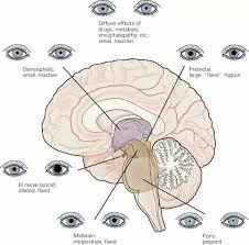 Image result for Coma Exam