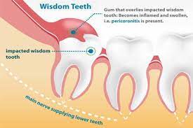 Pin On Dental Surgery