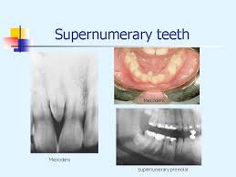 Check spelling or type a new query. Abnormalities Of The Teeth Environmental Effects On Tooth
