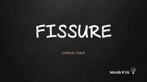 Record yourself saying 'fissure' in full sentences, then watch yourself and listen. How To Pronounce Fissure In American English Youtube