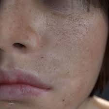 Artstation Blender 3d Cycles Skin Shader Vers 6 Examples Team Dee Van Hoven Jle Studios Blender 3d Human Skin Texture Skin Textures