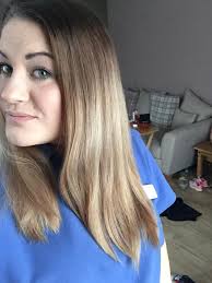 Why am I experiencing increased hair loss?