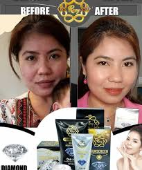 ឈុតមុខមួយនេះជួយព្យាបាលមុនអាចម៌រុយជាំខ្មៅនៅលើស្បែកមុខនៅលើទឹកដីអាមេរិក🇺🇸អាចកម្មង់បាន👉🇺🇸📱714  8802195