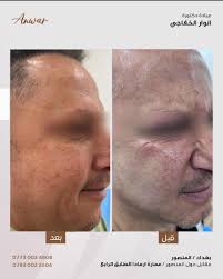 Anwar Issa Hasan (@dr_anwar_isaa) · Baghdad