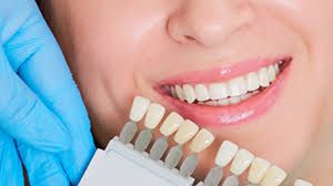 Be careful not to press too hard at once as too much. Fix The Gaps In Your Teeth With Porcelain Veneers In Fremont