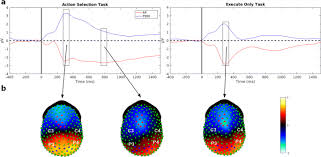 Timing Of Readiness Potentials Reflect A Decision Making Process In The Human Brain Springerlink