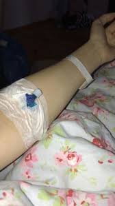 Sama seperti prosedur medis pada umumnya, tangan di infus juga dapat menimbulkan efek samping. Pipuy Pipupi2421 Profil Pinterest
