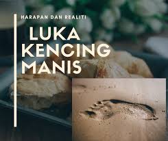 Ubat kencing manis peria katak hutan 100% herba dibawah jenama extra peria ternyata mampu membantu menurunkan kadar kencing manis dengan berkesan. Luka Kencing Manis Harapan Pesakit Dan Realiti Klinik Putra