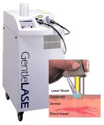 The best permanent hair removal cream in 2021 (face and body) Laser Hair Removal New Jersey Permanent Hair Removal Glasgold Group