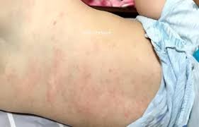 This is 伊波拉病毒的真相：cnn製作 by otakuarmy on vimeo, the home for high quality videos and the people who love them. ç—…æ¯'ç–¹ åª½å'ªæ‹œmamibuy