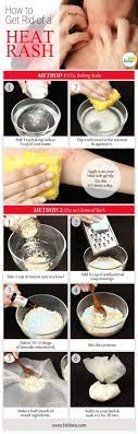 Pat it dry and apply moisturizing cream / olive oil on the heat rash as the primary remedy. Best Home Remedy To Get Rid Of Heat Rash While Summer Is A Particularly Pleasant Time Of Year For Many It Can Turn Heat Rash Rashes Remedies Heat Rash Remedy