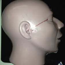 PDF) Validation of a simulator for temporomandibular joint arthroscopy