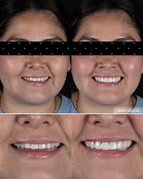 Hola!, mi nombre es Karla Esquer soy cirujano dentista egresada de la  Universidad Autónoma de Baja California, una de las cosas que mas me gusta  hacer de mi trabajo es realizar diseños