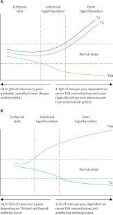 Image result for Subclinical Hyperthyroidism