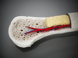 Bone marrow is the soft, highly vascular and flexible connective tissue within bone cavities which serve as the primary site of new blood cell production or bone marrow is the primary source of pluripotent stem cells that give rise to all hemopoietic cells (blood cells) including lymphocytes. Red Bone Marrow Vs Yellow Bone Marrow Peconic Bay Medical Center