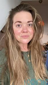 High-flying 33-year-old left unable to speak or walk due to stroke now  confidently back dating after remarkable recovery