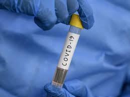 Here we allow the following types of posts: Telangana Corona News Covid 19 Deaths Of Patients With No Comorbidities Rising In Telangana Hyderabad News Times Of India