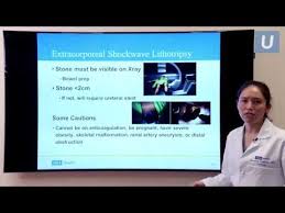 Lithotripsy: Purpose, Procedure, And Risks