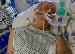 Legionnaires disease (ld) is the pneumonia caused by legionella pneumophila. Legionnaires Disease Capron Avgerinos