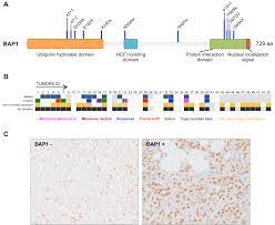 Several findings underscore the apparent driver role of bap1 in malignant mesothelioma (mm). Bap1 Is Altered By Copy Number Loss Mutation And Or Loss Of Protein Expression In More Than 70 Of Malignant Peritoneal Mesotheliomas Journal Of Thoracic Oncology