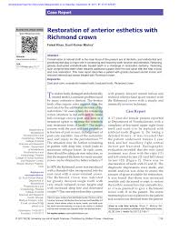 Maybe you would like to learn more about one of these? Pdf Restoration Of Anterior Esthetics With Richmond Crown