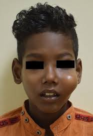 Journal of Clinical Pediatric Dentistry (JOCPD)