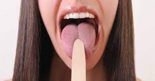 Lengua Hinchada De Forma Repentina Debo Preocuparme