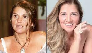 Morte de namorado de atriz Carla Daniel não foi causada por queda, diz  necropsia