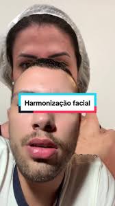 Harmonização Facial com o Dr. Igor Costa Alves