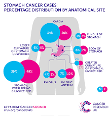 Let's consider what is stomach cancer, how to determine it and most importantly, how to cure this disease. Stomach Cancer Incidence Statistics Cancer Research Uk