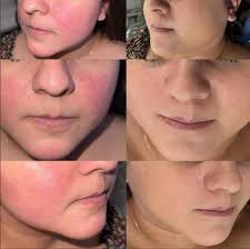 Dr. Roberto Enríquez Moo Dermatólogo, Mérida