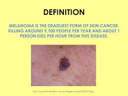Cells that make melanin and are found in the lower part of the epidermis. Melanoma Riley And Edie Ppt Download