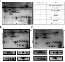 Since the new 1.213 update allows you to use custom xfer serum skins, there are many producers giving away their own creations as a free download, . Identification Of Major Serum Proteins And Proteomic Profile Of Serum Download Scientific Diagram