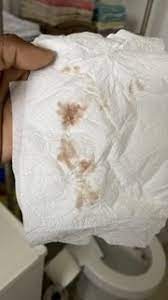 Maybe you are losing your mucus plug. Light Pink Then Brown Discharge 4 Weeks 2 Days Positive Pregnancy Test Worried Please Help March 2016 Babycenter Australia