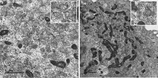 Collect an ampoule of cells from liquid nitrogen storage wearing appropriate personal protective equipment and transfer to the laboratory in a container of liquid nitrogen or on dry ice. Ultrastructural Modifications Induced By Sars Cov 2 In Vero Cells A Kinetic Analysis Of Viral Factory Formation Viral Particle Morphogenesis And Virion Release Springerlink