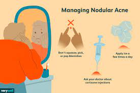 In conclusion, both nodular acne and cystic acne have similar nodules, but cysts are. Causes Of Nodular Acne And How To Treat It