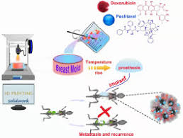 However, there are many different symptoms of breast cancer, and. 3d Printing Based Drug Loaded Implanted Prosthesis To Prevent Breast Cancer Recurrence Post Conserving Surgery Sciencedirect