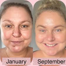 6 months from now You'll be living in your healed, happy, hot girl era..  money flowing, stress gone, skin glowing 😍✨🫶🏽